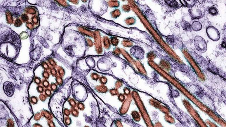 O sintoma mais frequente relacionado ao vírus H5N1 é a irritação nos olhos
