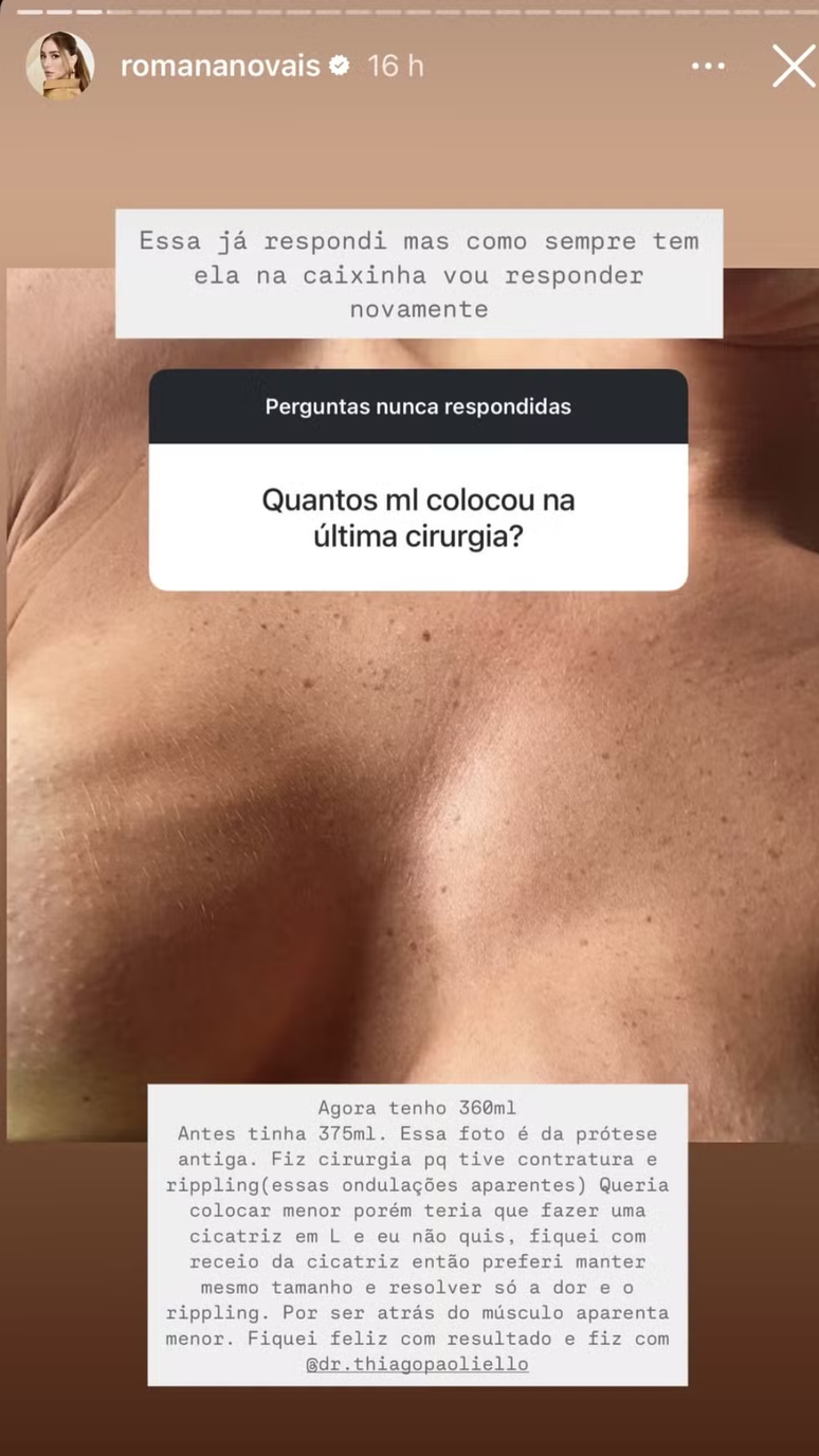 Roman Novais shows breast crawling Roman Novais shows breast crawling
