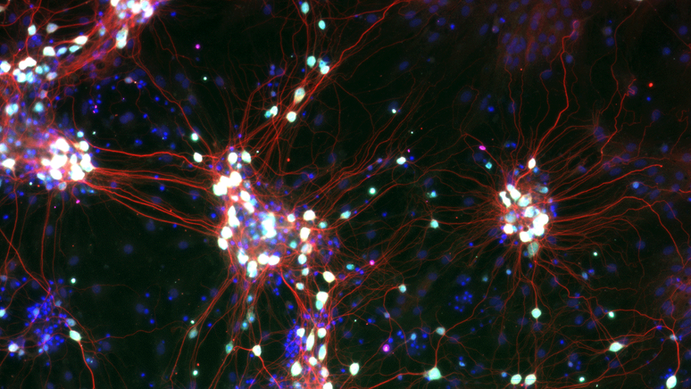 Empresas como a Cortical Systems trabalham em 'organoides' feitos de c&eacute;lulas nervosas