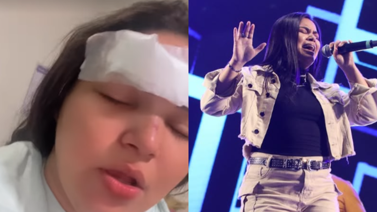 The singer is beaten in bars and surprises reasons: “Hair full of blood”