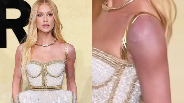 What happened? Marina Roy Barbosa is justified after appearing with her purple arm during an event