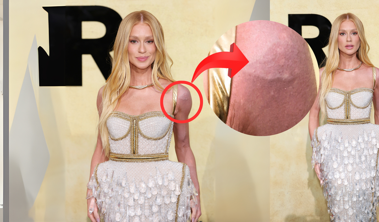 A explicação de Marina Ruy Barbosa sobre ombro roxo em Cannes é o verdadeiro significado de perrengue chique: 'O vestido...'.