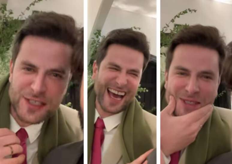 O ex-BBB Gustavo Marsengo ap&oacute;s fazer harmoniza&ccedil;&atilde;o facial.