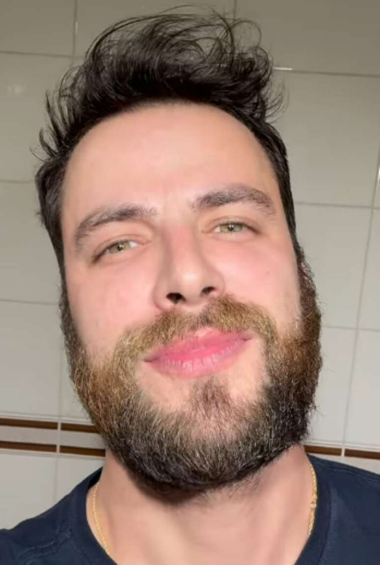 O ex-BBB Gustavo Marsengo em imagem recente, antes de harmoniza&ccedil;&atilde;o facial.
