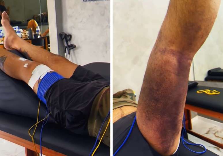 Juliano Cazarr&eacute; se submete a fisioterapia ap&oacute;s cirurgia