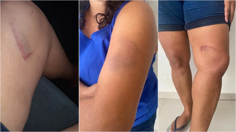 Supermercado e funcion&aacute;rios s&atilde;o condenados por tortura em cliente acusada de roubar produtos