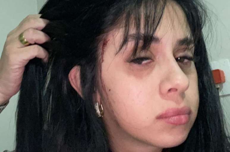 Débora Amorim foi agredida em frente a sua casa em Blumenau (SC)