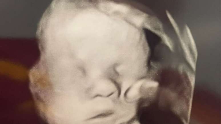 A ca&ccedil;ula que foi respons&aacute;vel por notar a m&atilde;o misteriosa sobre a face de seu irm&atilde;o no ultrassom; veja mais detalhes sobre esta hist&oacute;ria