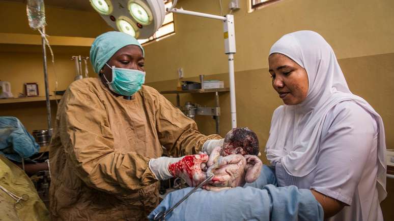In Nigeria, there is a lack of qualified health professionals