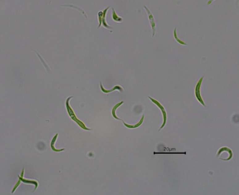Microalgas reduziram, em laboratório, a quantidade de antibióticos em uma amostra de água poluída.