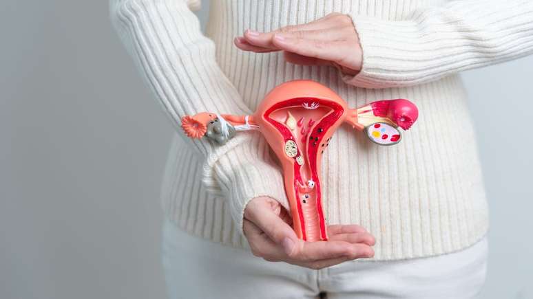 Sintomas que vão além da cólica: entenda o que é a endometriose, condição que afeta milhares de mulheres no Brasil
