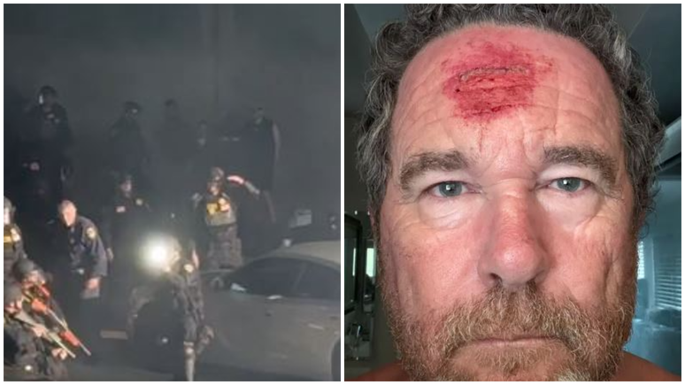 Fotógrafo registra momento em que é atingido por tiro de policial durante protestos nos EUA