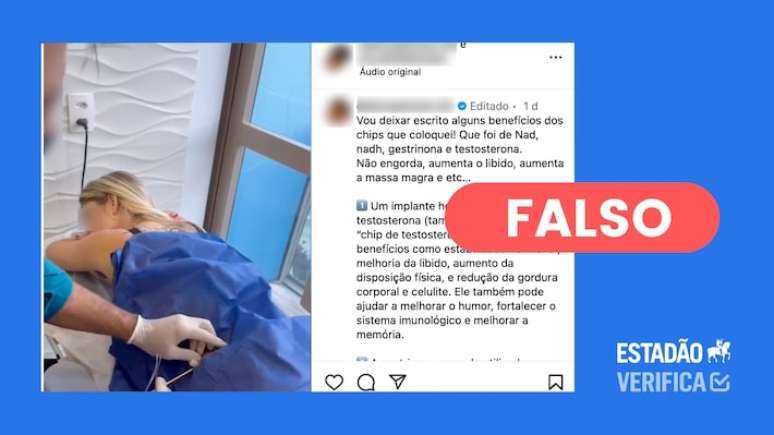 Endocrinologistas apontam que os riscos que implantes hormonais podem causar são maiores do que qualquer benefício.