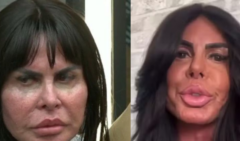 Before and after Gretchen: famous shows a new face after removing the fillers and stimulated collagen; The plastic surgeon explains the treatments