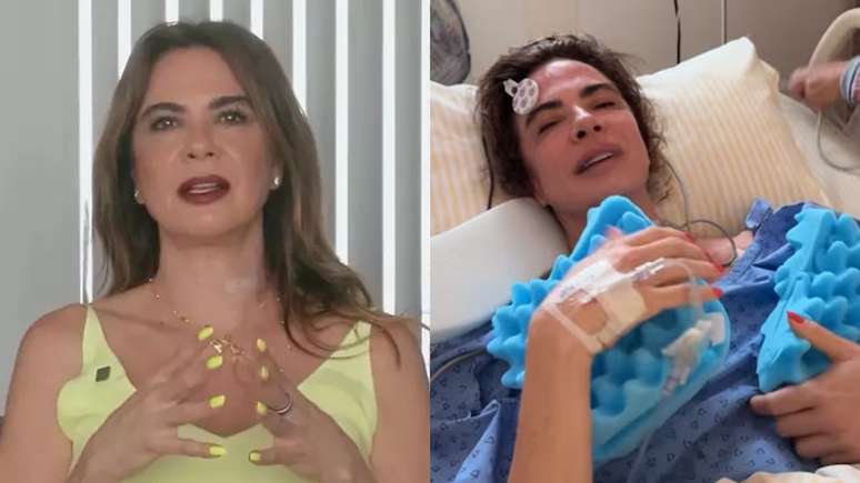 Luciana Gimenez detailed despair after surgery: “More horrible I have ever tried”