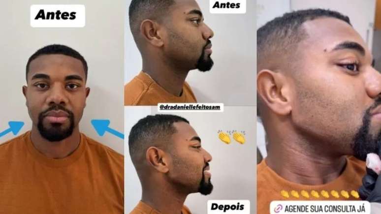 Antes e depois de Davi Brito