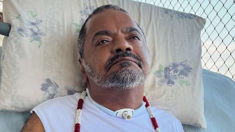 Arlindo Cruz ficou internado por 50 dias no Rio de Janeiro e precisou colocar um dreno; sambista terá alta em breve