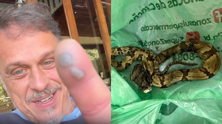 Guilherme Fontes é picado por cobra