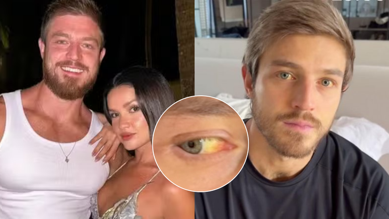 É grave? Namorado de Juliette recebe alta, mas segue com pele e olhos amarelados