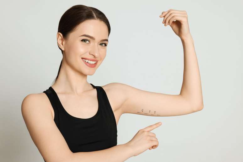 Surgery can be performed to correct excess fat in the arm Surgery can be performed to correct excess fat in the arm
