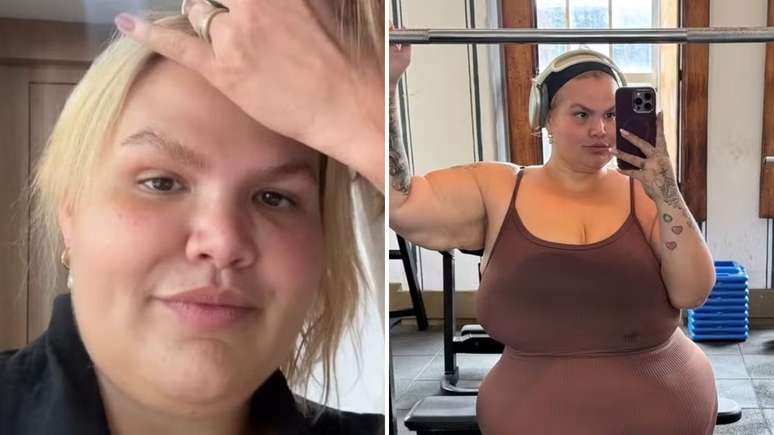 O que Thais Carla tem? Influencer compartilhou alguns dos efeitos colaterais ap&oacute;s o procedimento e se queixou nas redes sociais; entenda