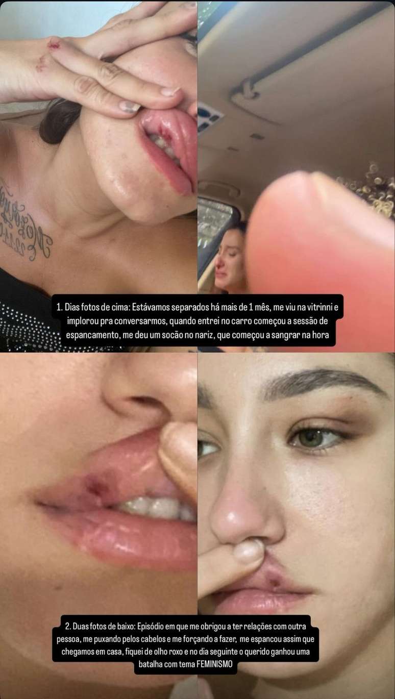 Ex de MC Estudante mostrou fotos de agress&otilde;es em sua conta no Instagram &mdash;