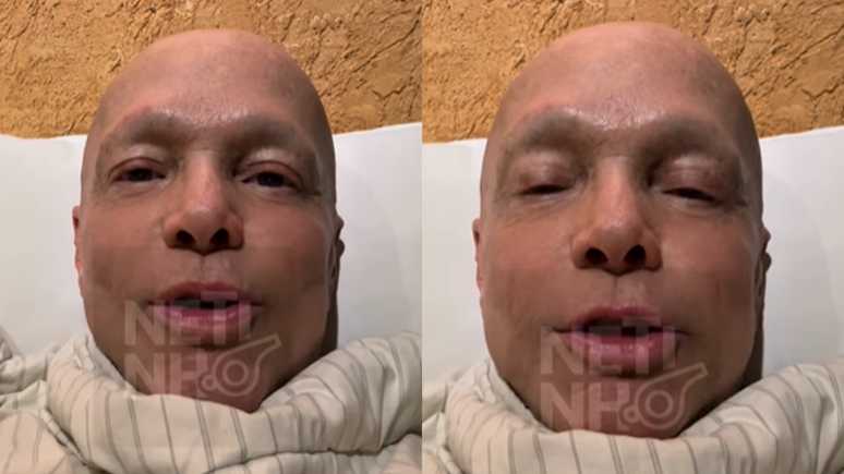 Após quimioterapia, cantor Netinho surge abatido e revela desejo: 'Vontade imensa'