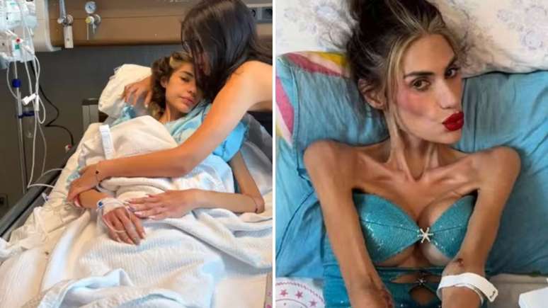 The nutritionist explains the death of the influencer with 22.5 kg: “The body can no longer defend itself” The nutritionist explains the death of the influencer with 22.5 kg: “The body can no longer defend itself”