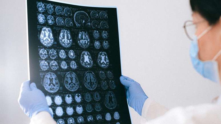 The research reveals a sign of Alzheimer who can arise 25 years earlier; misunderstanding