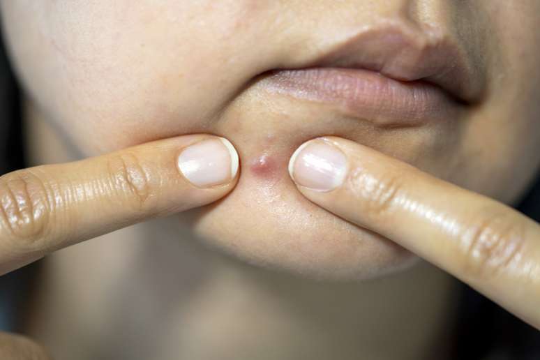 Why is it so nice to watch videos of blackheads that broke out or heavy cleaning? Psychology explains