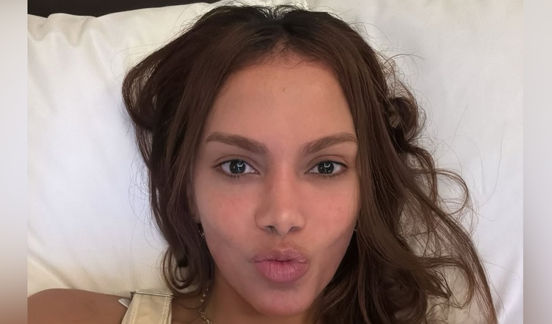 Anitta fez preenchimento labial e harmonização facial? A posição oficial da equipe da cantora sobre rumores do ‘novo rosto’.