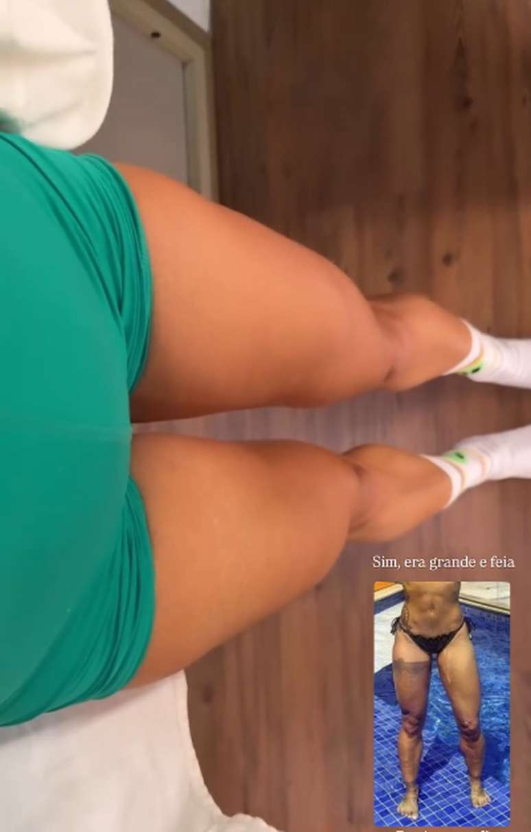 Aline Campos &mdash;