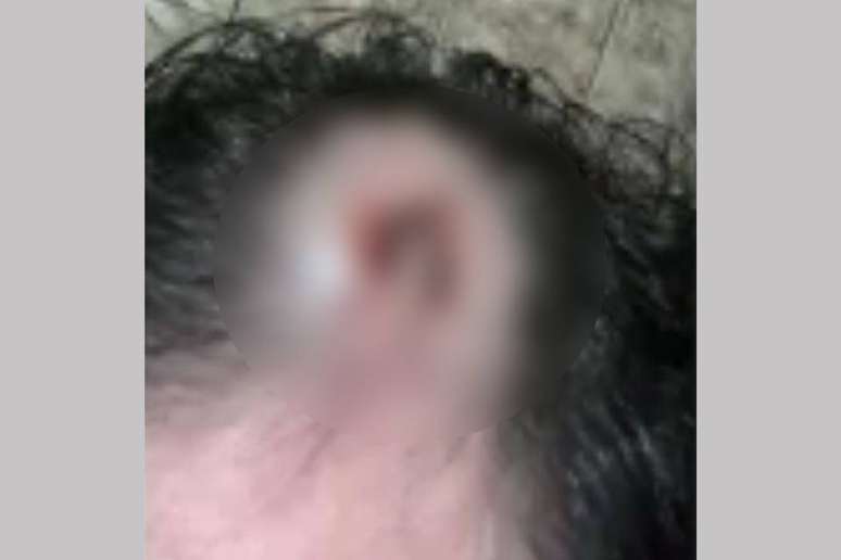 Personal trainer desmaiou ap&oacute;s ser golpeado com peso na cabe&ccedil;a