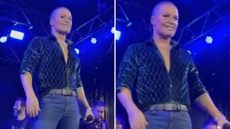 Cantor surpreende com novo visual em Matupá e explica influência de transplante capilar no rosto