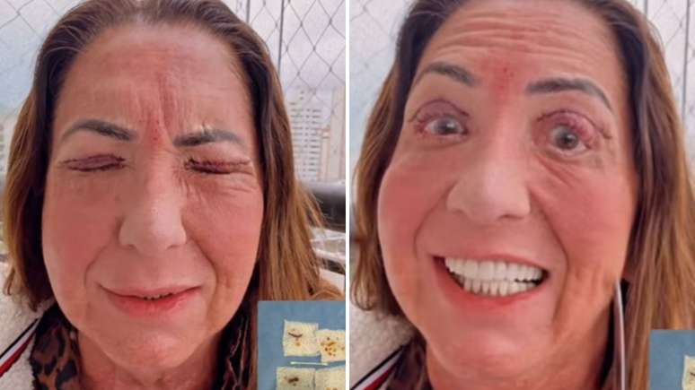 Virginia Fonseca’s mother has eye surgery and warnings: “It involves risks” Virginia Fonseca’s mother has eye surgery and warnings: “It involves risks”