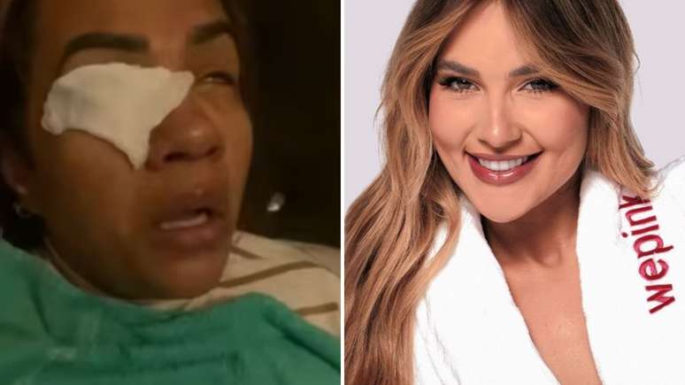 Mulher diz ter ficado cega ao usar produto da WePink, a marca de cosm&eacute;ticos de Virginia Fonseca; saiba o que aconteceu