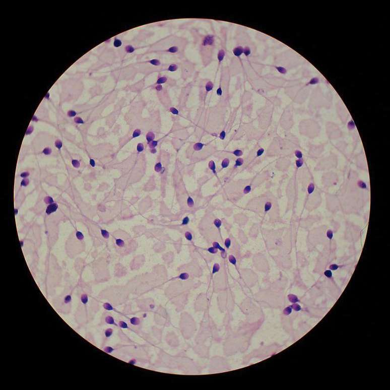 Os espermatozoides s&atilde;o t&atilde;o min&uacute;sculos que estud&aacute;-los pode ser dif&iacute;cil. &Eacute; poss&iacute;vel colorir as amostras para facilitar sua observa&ccedil;&atilde;o no microsc&oacute;pio.