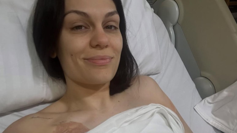 The singer regretted not having “shot from the breast” before surgery to treat cancer The singer regretted not having “shot from the breast” before surgery to treat cancer