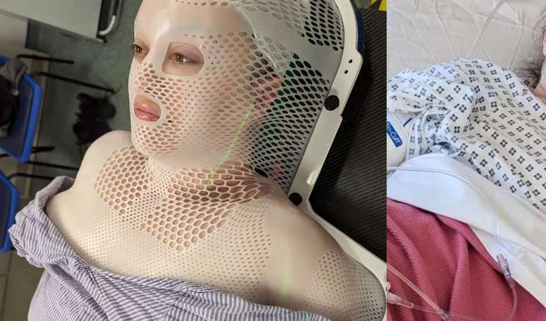 Mulher grávida de 44 anos achou que tinha distendido um músculo na aula de ioga, mas caroço na perna se revelou um câncer raro e incurável.