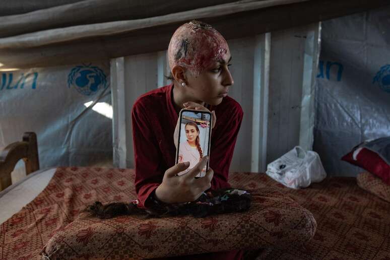 Jovem palestina ferida mostra sua imagem antes de ser atingida por ataques das IDF