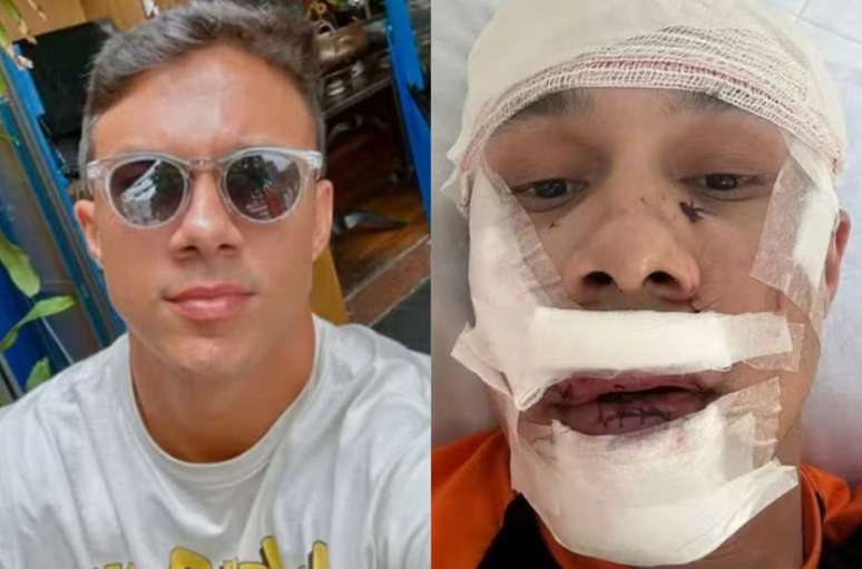 Thiago Medeiros foi agredido em Águas de Lindoia (SP)