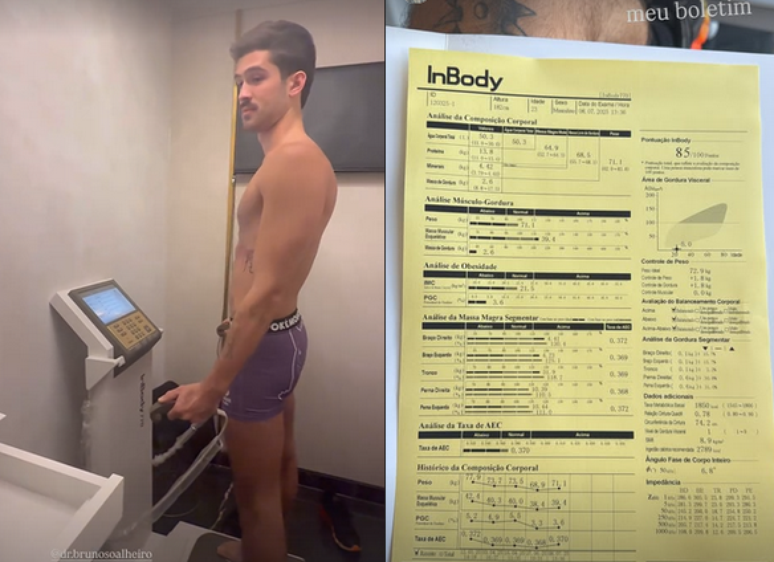 Jo&atilde;o Guilherme apareceu usando uma cueca do P&oacute;kemon durante sua avalia&ccedil;&atilde;o no nutricionista