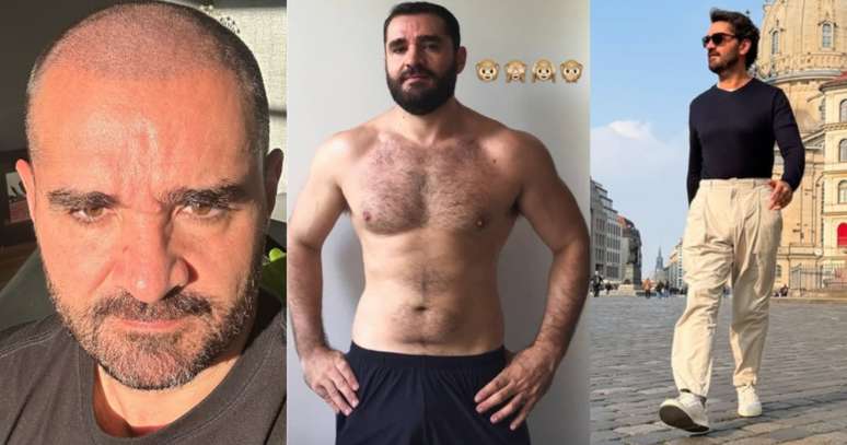 The presenter when he was bald for the system; Beyond, the appearance The presenter when he was bald for the system; Beyond, the appearance