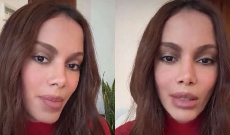 “It would be even more horrible for my life …”: after the new plastic, Anitta reacts to the voices “psychological problem” by different face