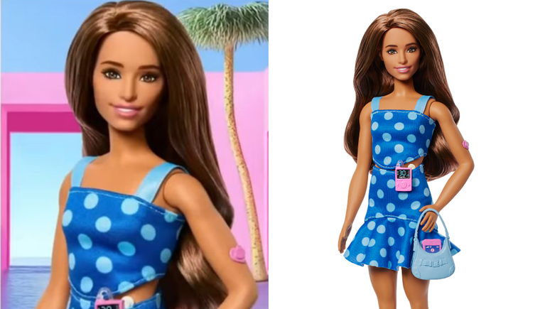 A nova Barbie, vestida com um conjunto azul de bolinhas, usa um medidor de glicose no braço, além de uma bomba de insulina na cintura