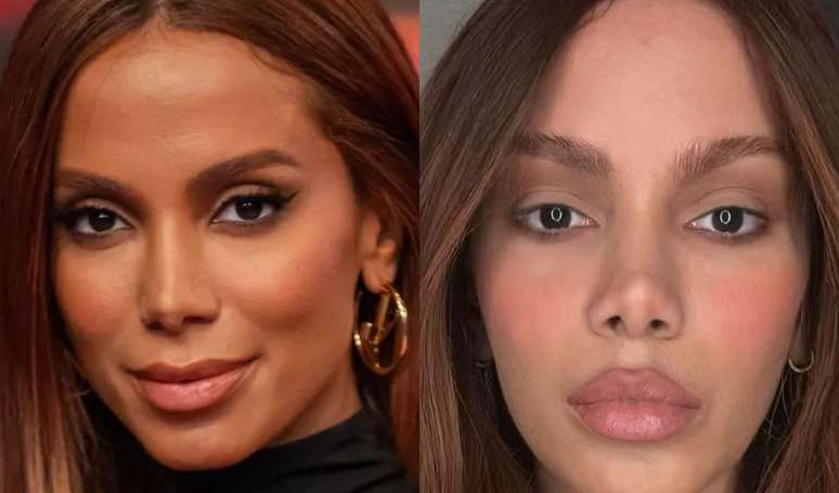 New face? Not everything is only scalpel! Expert explains what could be behind the renewed beauty of Anitta, Emma Stone and the most famous