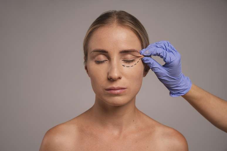 Blefaroplastia é uma cirurgia nas pálpebras