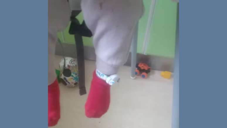 Tornozeleira na perna esquerda do bebê