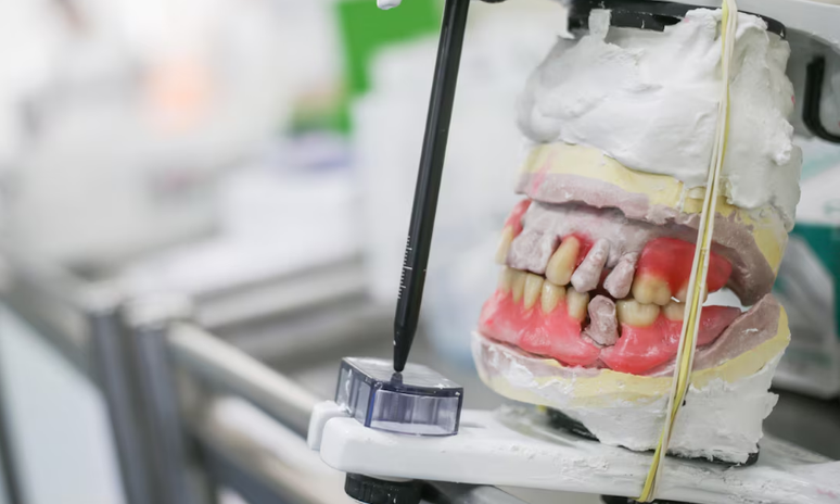 Prática de odontologia biológica não é reconhecida pelo Conselho Federal de Odontologia (CFO), autoridade reguladora da profissão, como especialidade nem como habilitação