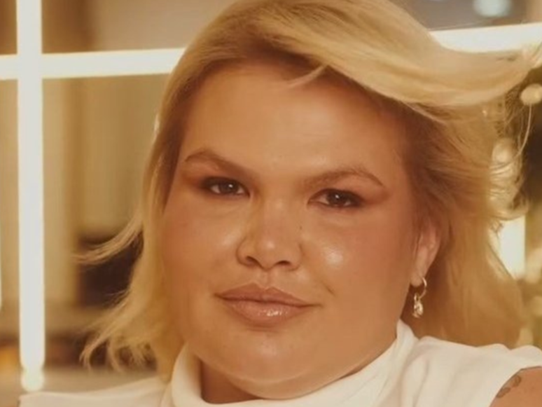 Thais Carla reveals the problem that is facing after bariatric surgery Thais Carla reveals the problem that is facing after bariatric surgery